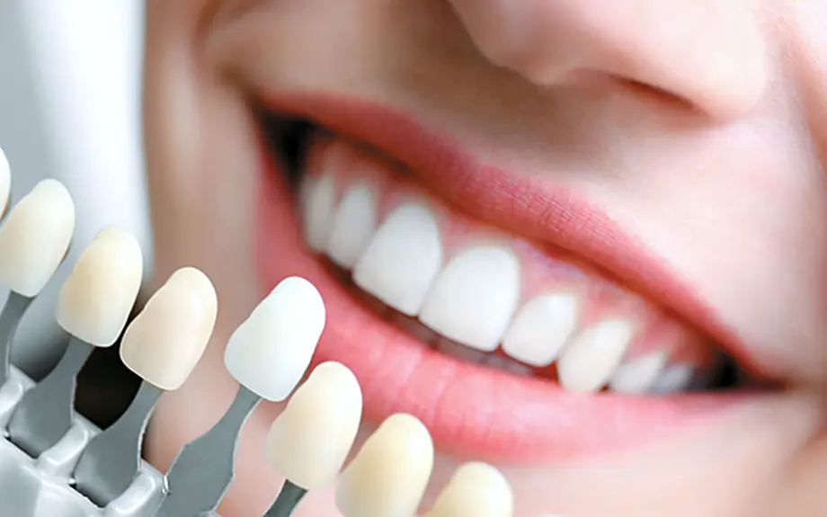 Dental Exams & Cleanings at Brighter Smile, North Vancouver