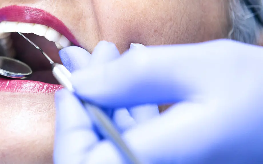 Root Canal Therapy at Brighter Smile, North Vancouver