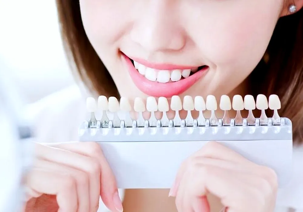 Cosmetic Dentistry at the Brighter Smile clinic in North Vancouver