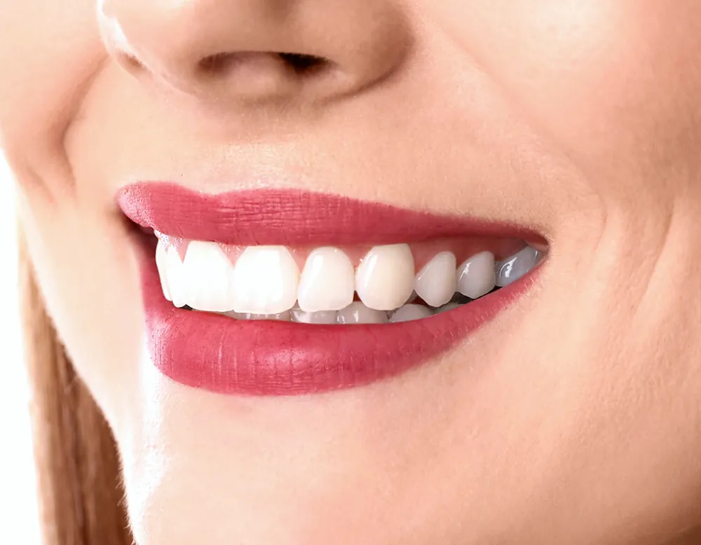 Dental Exams & Cleanings at the Brighter Smile clinic in North Vancouver